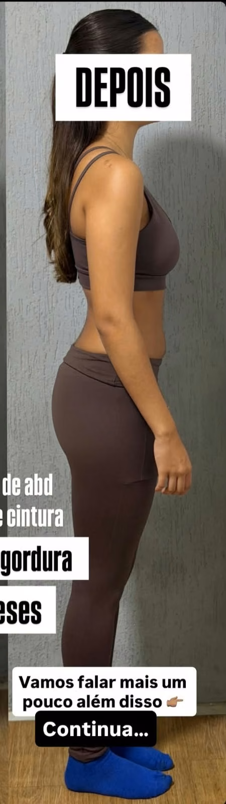 Depois, leitura A, 2 meses.