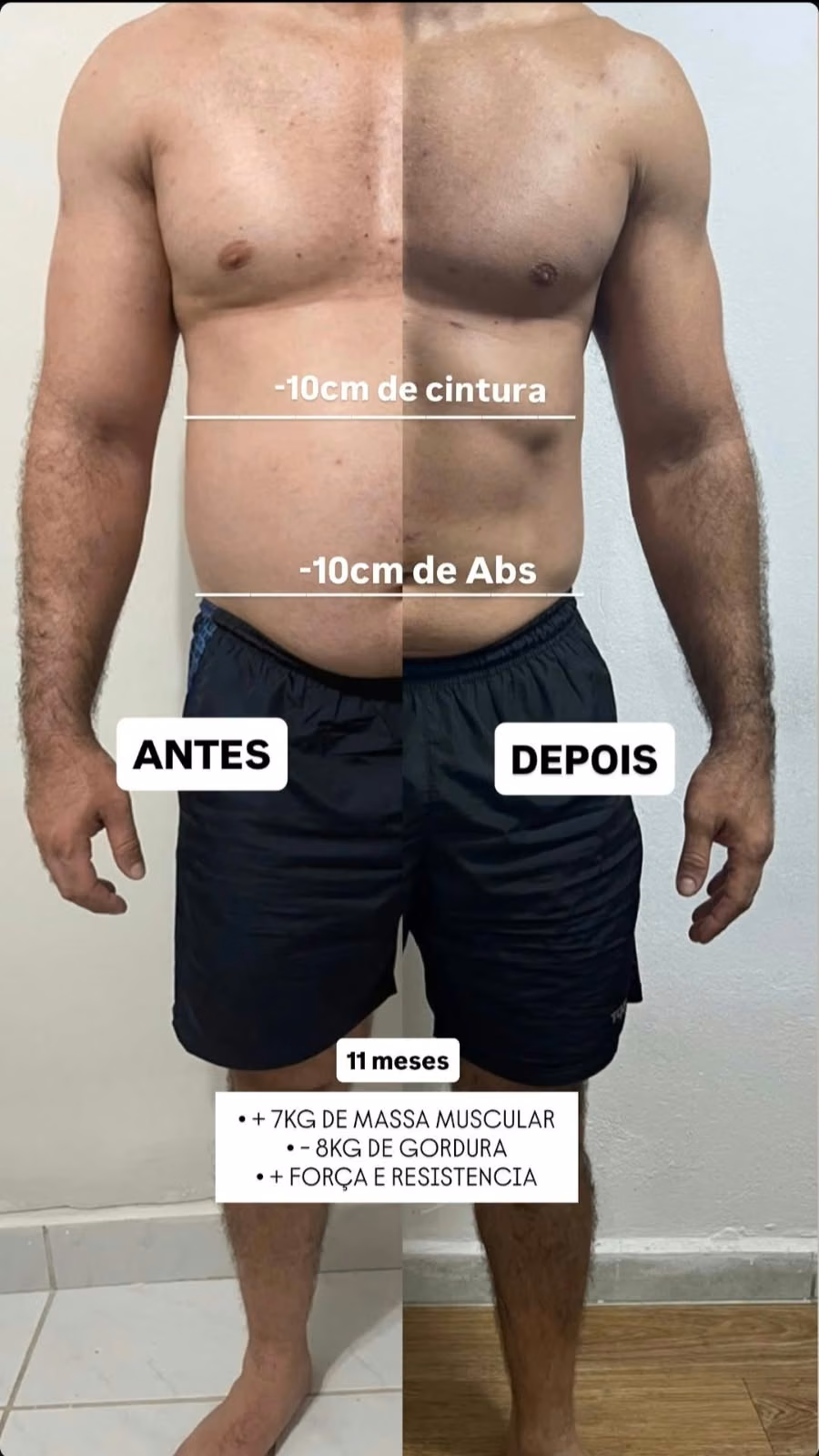Antes e depois, leitura D, 11 meses.